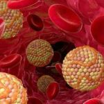 Медики назвали симптом повышенного холестерина