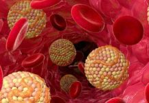 Симптомы высокого холестерина, которые нельзя игнорировать