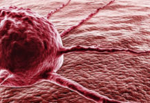 Рак легких можно определить по глазам — медики