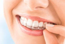 Производство и применение элайнеров