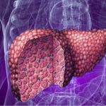 Очищение печени — правда и мифы