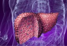 Очищение печени — правда и мифы