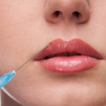 Сделайте пухлые губки с помощью филлеров на День святого Валентина