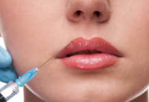 Сделайте пухлые губки с помощью филлеров на День святого Валентина
