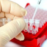 Анализ крови будет способен выявить заболевание печени на ранней стадии — медики