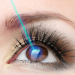 Какое зрение будет после лазерной коррекции зрения?