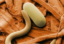 Врачи рассказали, чем особенно опасно заражение глистами