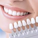 Протезирование зубов: показания для процедуры