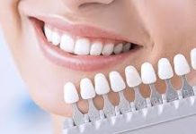 Протезирование зубов: показания для процедуры