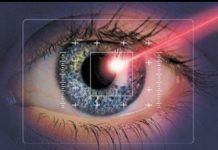 Как осуществляется лазерная коррекция зрения?