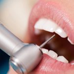 Гигиеническая чистка в Вэнстом