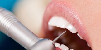 Гигиеническая чистка в Вэнстом